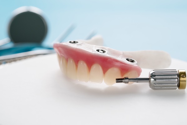 What You Need To Know About Partial Dentures